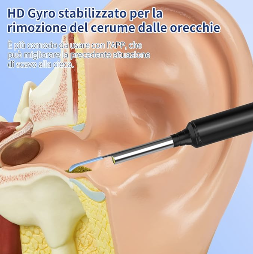 Strumento per Rimuovere il Cerume con Telecamera HD e Luci LED